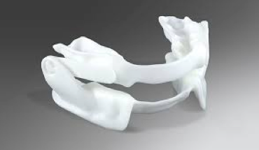 Example of Oral Appliance